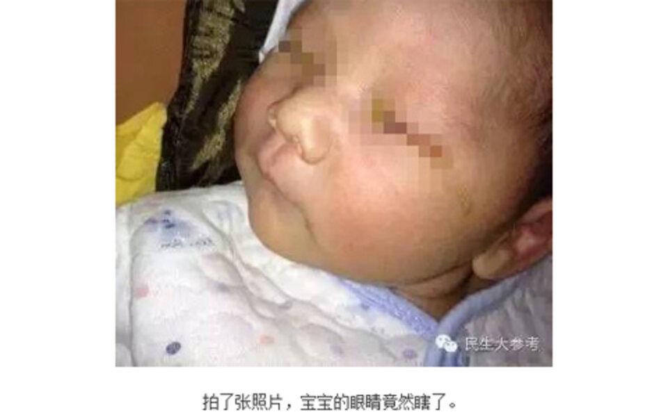 Kamera-Blitz ließ Baby erblinden