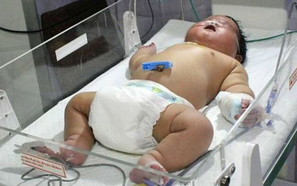 6,7-Kilo-Baby in nur 15 Minuten geboren