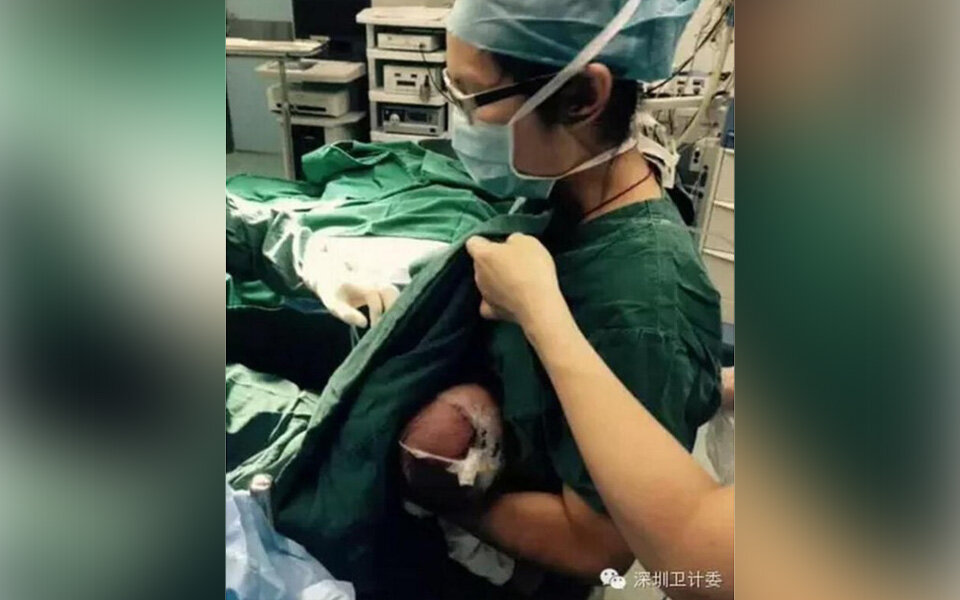 Krankenschwester stillte Baby während OP