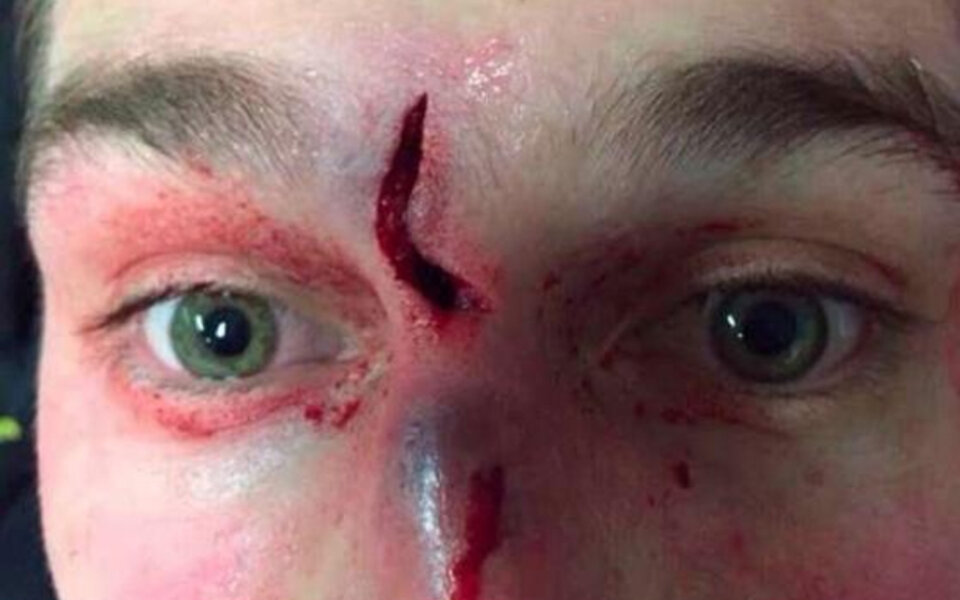 Eishockey-Star postet Horror-Selfie