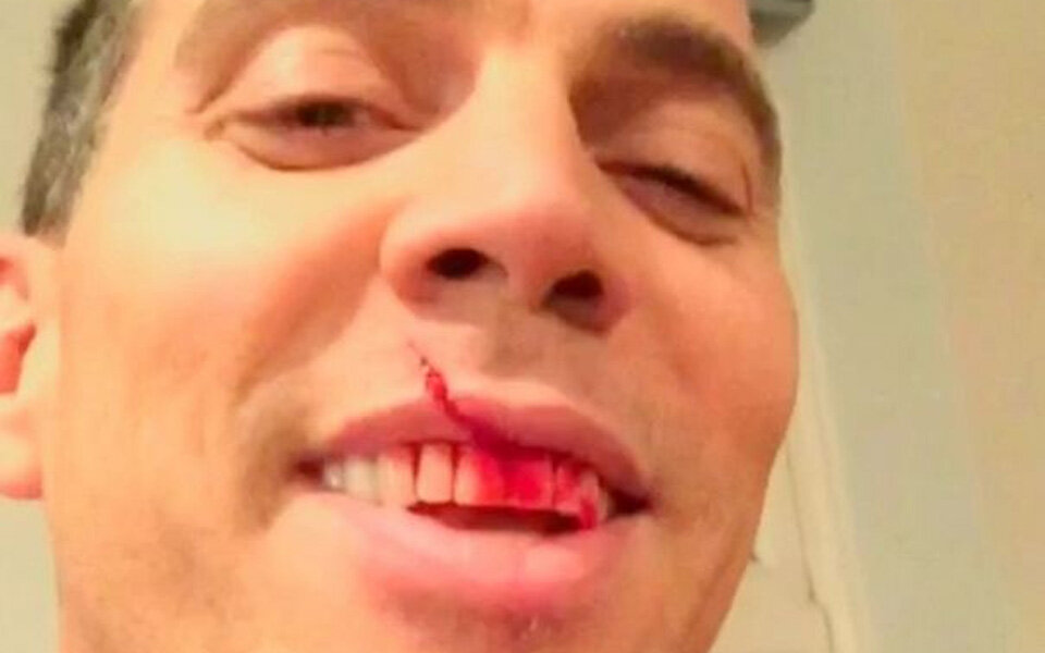 Jackass-Star verletzte sich bei Messer-Stunt